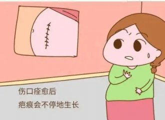 疤痕疙瘩治疗新突破：哪种方法更好？